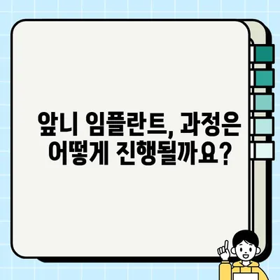 앞니 임플란트 가격 안내| 미소의 가치 | 비용, 과정, 후기, 추천